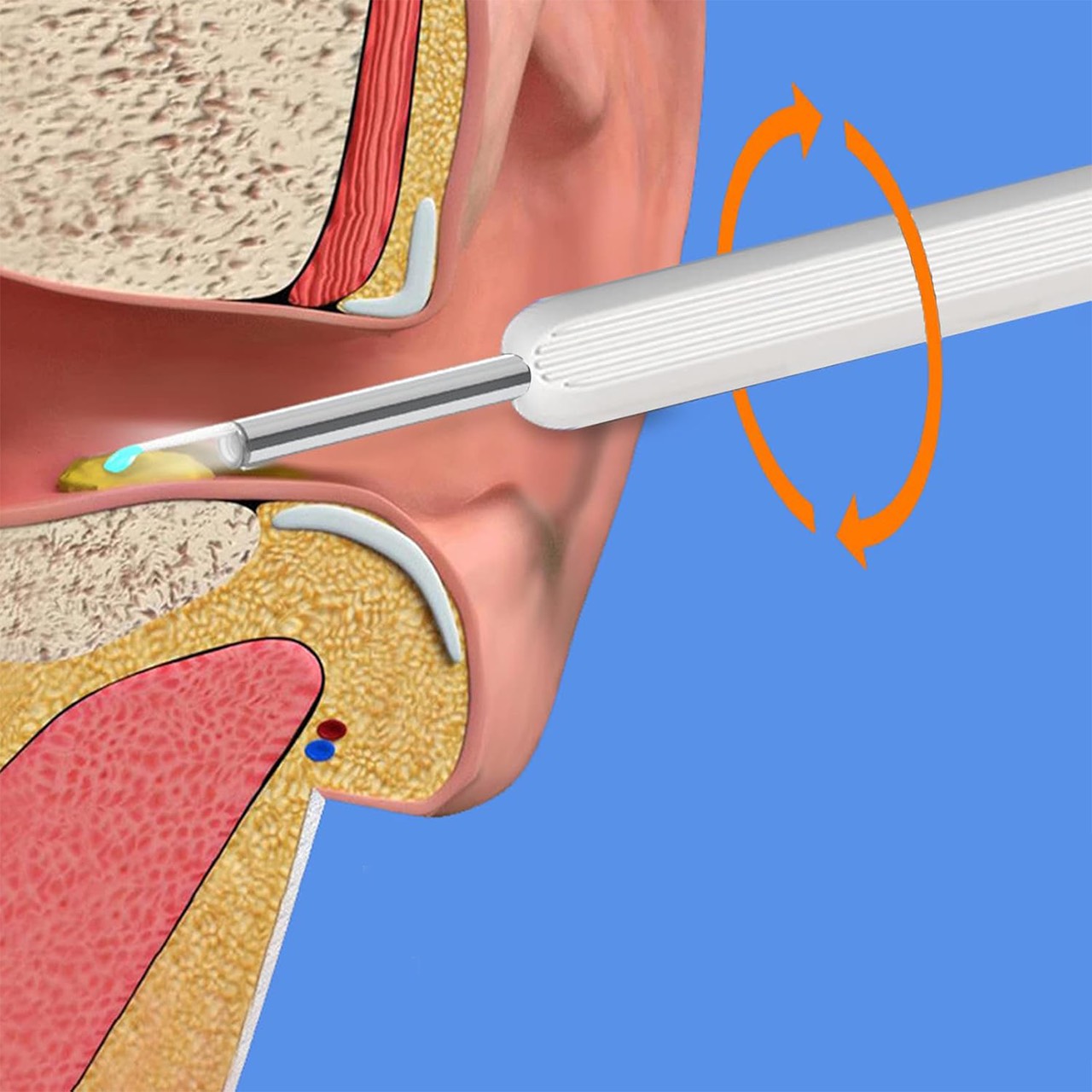 EarStick, pomoc do czyszczenia woskowiny usznej z kamerą - Image 2