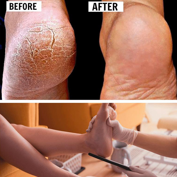 FootFile, najlepszy pilnik do pedicure - Image 7